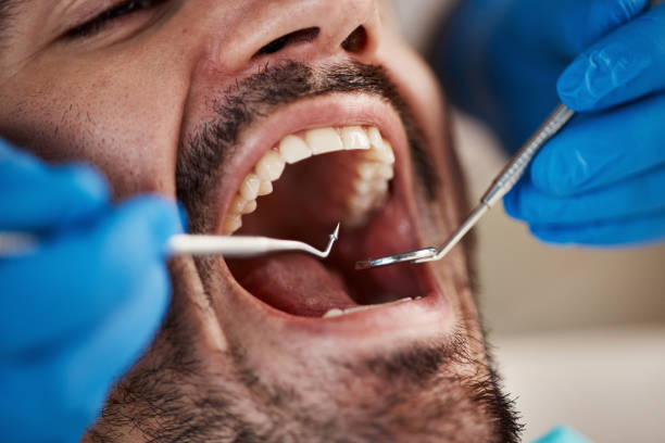 Best Emergency Dental Surgery in Thornton, IL