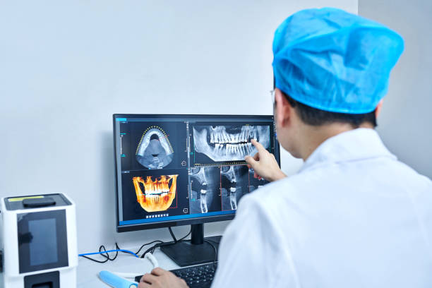 Best Emergency Root Canal Treatment in Thornton, IL